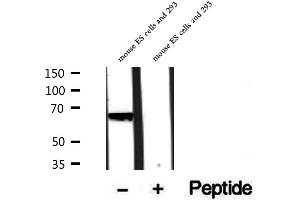 Western blot analysis of extracts of rat brain tissue, using PHF19 antibody. (PHF19 抗体  (Internal Region))