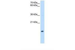 Image no. 1 for anti-NADH Dehydrogenase (Ubiquinone) 1 beta Subcomplex, 5, 16kDa (NDUFB5) (AA 69-118) antibody (ABIN6738155) (NDUFB5 抗体  (AA 69-118))