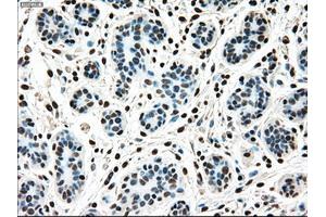 Immunohistochemical staining of paraffin-embedded breast tissue using anti-MAP2K4 mouse monoclonal antibody. (MAP2K4 抗体)