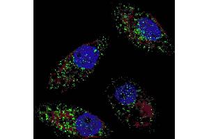 Fluorescent image of  cells stained with cleaved LC3B antibody. (LC3B 抗体  (cleaved))