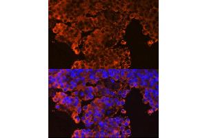 Immunofluorescence analysis of rat pituitary gland cells using GHRHR Rabbit pAb (ABIN6127953, ABIN6141077, ABIN6141078 and ABIN6224478) at dilution of 1:100 (40x lens). (GHRHR 抗体  (AA 1-130))
