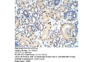 Rabbit Anti-ANP32A Antibody  Paraffin Embedded Tissue: Human Kidney Cellular Data: Epithelial cells of renal tubule Antibody Concentration: 4. (PHAP1 抗体  (Middle Region))