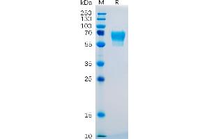 Human CD27 Protein, hFc Tag on SDS-PAGE under reducing condition.