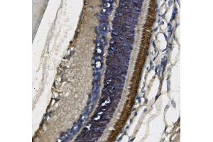 IHC analysis of PDE6 beta/PDE6B using anti-PDE6 beta/PDE6B antibody (ABIN7600893). (PDE6B 抗体  (AA 25-237))