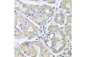 Immunohistochemistry of paraffin-embedded human gastric using CEP57L1 antibody at dilution of 1:100 (x40 lens). (CEP57L1 抗体)