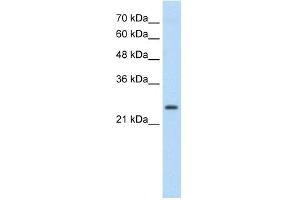 TSHR antibody used at 0. (TSH receptor 抗体  (C-Term))