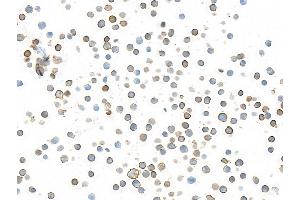 Immunocytochemistry (ICC) image for anti-CD226 (CD226) (AA 19-229) antibody (ABIN7455092) (Recombinant CD226 抗体  (AA 19-229))
