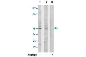 Western blot analysis of extracts from 293 cells (Lane 1) and HUVEC cells (Lane 2 and lane 3), using CSTF1 polyclonal antibody . (CSTF1 抗体  (N-Term))