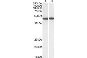 Western Blotting (WB) image for anti-Actin, alpha 2, Smooth Muscle, Aorta (ACTA2) (N-Term) antibody (ABIN185271)