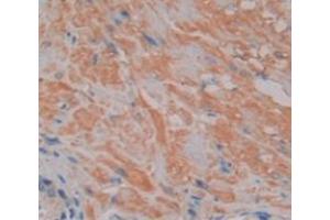 IHC-P analysis of Human Tissue, with DAB staining. (NFAT1 抗体  (AA 392-574))