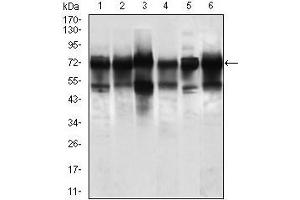 Western blot analysis using WHSC2 mouse mAb against Jurkat (1), HeLa (2), HEK293 (3), A549 (5), SPC-A-1 (6) cell lysate, and Rat brain (4) tissue lysate. (WHSC2 抗体  (AA 280-511))