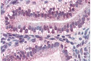 Human Uterus (formalin-fixed, paraffin-embedded) stained with CRABP2 antibody ABIN364443 at 10 ug/ml followed by biotinylated anti-mouse IgG secondary antibody ABIN481714, alkaline phosphatase-streptavidin and chromogen. (CRABP2 抗体  (AA 1-138))