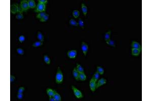 Immunofluorescent analysis of HepG2 cells using ABIN7159344 at dilution of 1:100 and Alexa Fluor 488-congugated AffiniPure Goat Anti-Rabbit IgG(H+L) (MLC1 抗体  (AA 1-49))