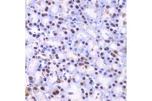 Immunohistochemistry of paraffin-embedded rat pancreas using XRCC4 antibody at dilution of 1:200 (400x lens). (XRCC4 抗体)