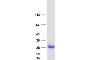 Validation with Western Blot