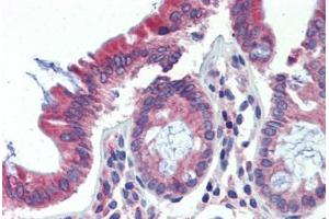 Human Colon (formalin-fixed, paraffin-embedded) stained with POLDIP3 antibody ABIN462229 followed by biotinylated goat anti-rabbit IgG secondary antibody ABIN481713, alkaline phosphatase-streptavidin and chromogen. (POLDIP3 抗体  (AA 326-375))