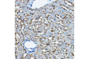 Immunohistochemistry (IHC) image for anti-Perilipin 2 (PLIN2) (AA 168-437) antibody (ABIN6145773)