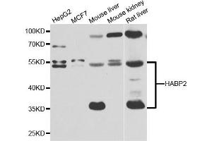 Western blot analysis of extracts of various cell lines, using HABP2 antibody. (HABP2 抗体)