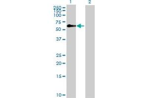 Western Blot analysis of ZFP3 expression in transfected 293T cell line by ZFP3 MaxPab polyclonal antibody. (Zinc Finger Protein 3 Homolog (ZFP3) (AA 1-502) 抗体)