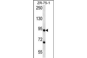 Western blot analysis in ZR-75-1 cell line lysates (35ug/lane). (CSTF3 抗体  (C-Term))