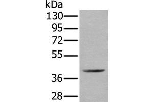 Western blot analysis of Mouse kidney tissue lysate using WDFY2 Polyclonal Antibody at dilution of 1:350 (WDFY2 抗体)