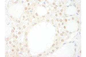 Immunohistochemistry (IHC) image for anti-WD Repeat Domain 20 (WDR20) (AA 450-500) antibody (ABIN7448862) (WDR20 抗体  (AA 450-500))