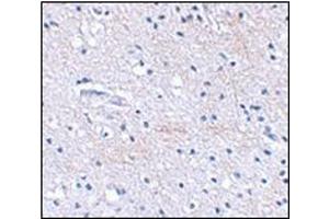 Immunohistochemical staining of human brain tissue using AP30768PU-N at 2. (FBXL20 抗体  (C-Term))