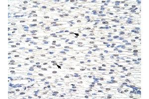 SNRPF antibody was used for immunohistochemistry at a concentration of 4-8 ug/ml to stain Myocardial cells (arrows) in Human Heart. (SNRPF 抗体  (N-Term))
