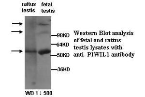 Image no. 1 for anti-Piwi-Like 1 (PIWIL1) (Internal Region) antibody (ABIN790869) (PIWIL1 抗体  (Internal Region))