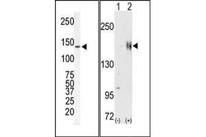 (LEFT)Western blot analysis of anti-ErbB2 Pab in SKBR-3 cell lysate. (ErbB2/Her2 抗体  (N-Term))
