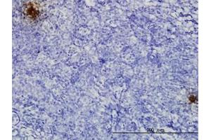 Image no. 3 for anti-Tissue Factor Pathway Inhibitor 2 (TFPI2) (AA 1-236) antibody (ABIN599020) (TFPI2 抗体  (AA 1-236))