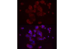 Immunofluorescence analysis of MCF7 cells using DKK3 Rabbit pAb (ABIN3016192, ABIN3016193, ABIN3016194, ABIN1679536 and ABIN6219615) at dilution of 1:50 (40x lens). (DKK3 抗体  (AA 22-350))