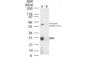 anti-Smallpox B5R (AA 180-194) antibody