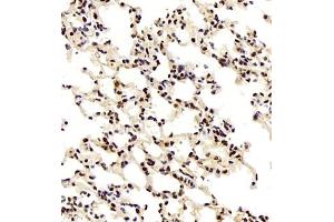 Immunohistochemistry of paraffin embedded mouse lung using smad62024 (ABIN7075629) at dilution of 1:1000 (400x lens) (SMAD6 抗体)