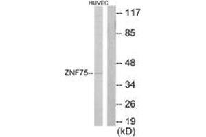 Western blot analysis of extracts from HuvEc cells, using ZNF75 Antibody. (ZNF75 抗体  (AA 296-345))
