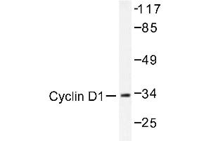 Image no. 1 for anti-Cyclin D1 (CCND1) antibody (ABIN272112) (Cyclin D1 抗体)