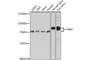 Western blot analysis of extracts of various cell lines using SNW1 Polyclonal Antibody at dilution of 1:1000. (SNW1 抗体)