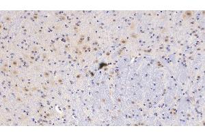 Detection of PEDF in Mouse Cerebellum Tissue using Monoclonal Antibody to Pigment Epithelium Derived Factor (PEDF)