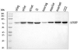 Western blot analysis of ADAM9 using anti-ADAM9 antibody (ABIN7601124). (ADAM9 抗体  (AA 29-307))