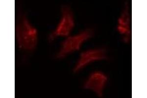 ABIN6278570 staining HuvEc by IF/ICC. (FASTKD2 抗体  (Internal Region))