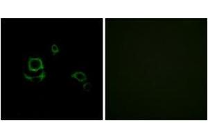 Immunofluorescence analysis of HuvEc cells, using F13B Antibody. (F13B 抗体  (AA 61-110))