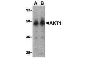 Western Blotting (WB) image for anti-V-Akt Murine Thymoma Viral Oncogene Homolog 1 (AKT1) (N-Term) antibody (ABIN1031225) (AKT1 抗体  (N-Term))