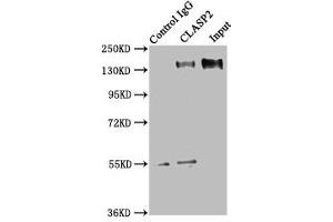 Immunoprecipitating CLASP2 in HEK293 whole cell lysate Lane 1: Rabbit control IgG instead of ABIN7147936 in HEK293 whole cell lysate. (CLASP2 抗体  (AA 226-381))