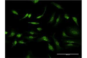 Immunofluorescence (IF) image for anti-Inhibitor of DNA Binding 1, Dominant Negative Helix-Loop-Helix Protein (ID1) (AA 47-155) antibody (ABIN516791)