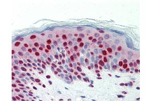 Anti-DCLRE1C / Artemis antibody IHC staining of human skin. (DCLRE1C 抗体  (AA 21-50))