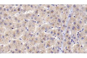 Immunohistochemistry (IHC) image for anti-Complement Component 1, Q Subcomponent, B Chain (C1QB) (AA 28-253) antibody (ABIN7445648)