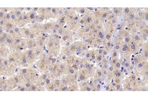 Detection of C1qB in Human Liver Tissue using Polyclonal Antibody to Complement Component 1, Q Subcomponent B (C1qB) (C1QB 抗体  (AA 28-253))