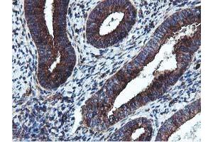 Immunohistochemical staining of paraffin-embedded Human endometrium tissue using anti-EPN2 mouse monoclonal antibody. (Epsin 2 抗体)