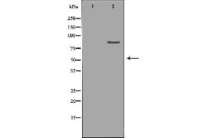 Western blot analysis of Hepg2 whole cell lysates, using CLCN5 Antibody. (Chloride Channel 5 抗体  (Internal Region))