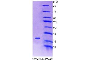 SDS-PAGE analysis of Human SLC30A3 Protein. (Slc30a3 蛋白)